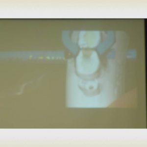 Curso odontologia estetica composite Dr. Walter Rogerio de Lima